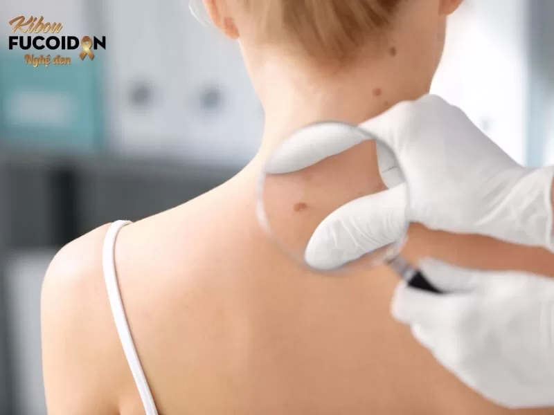 Tổng Quan Về Căn Bệnh Ung Thư Da Phương pháp chẩn đoán ung thư da