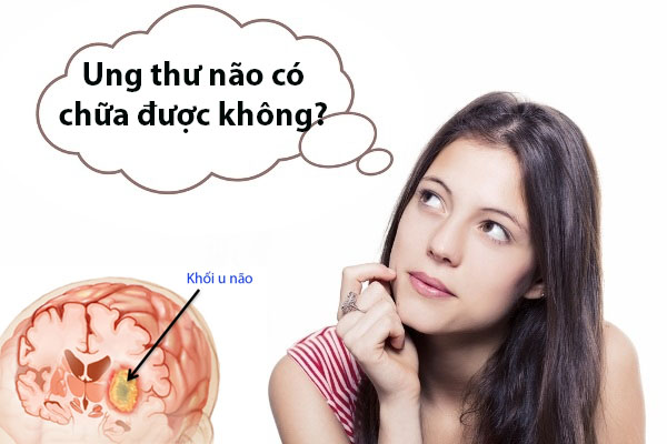 Tổng Quan Về Căn Bệnh Ung Thư Não ung-thu-nao-chua-duoc-khong