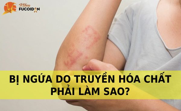 Bị ngứa sau khi truyền hóa chất phải làm sao? Khắc phục tình trạng bị ngứa do truyền hóa chất như thế nào?