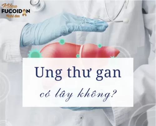 [Giải đáp] Ung thư gan có lây không? Làm sao để phòng ngừa ung thư gan?