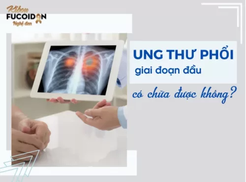 Ung thư phổi giai đoạn đầu có chữa được không? Sản phẩm nào hỗ trợ điều trị K phổi hiệu quả?