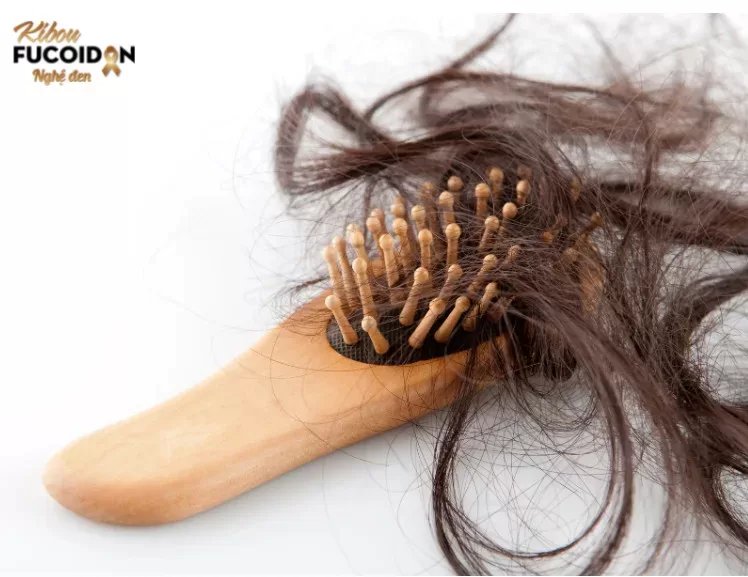 Rụng tóc là nỗi ám ảnh với nữ chiến binh K