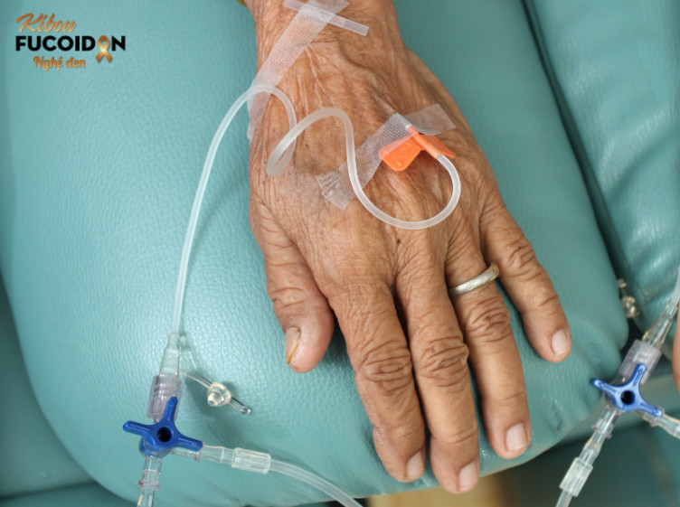 Làm sao làm giảm tác dụng phụ của thuốc hóa trị ung thư? Hóa trị chính là sử dụng hóa chất tiêu diệt tế bào ung thư