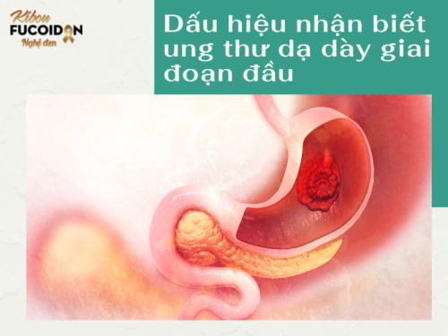 Dấu hiệu nhận biết ung thư dạ dày giai đoạn đầu