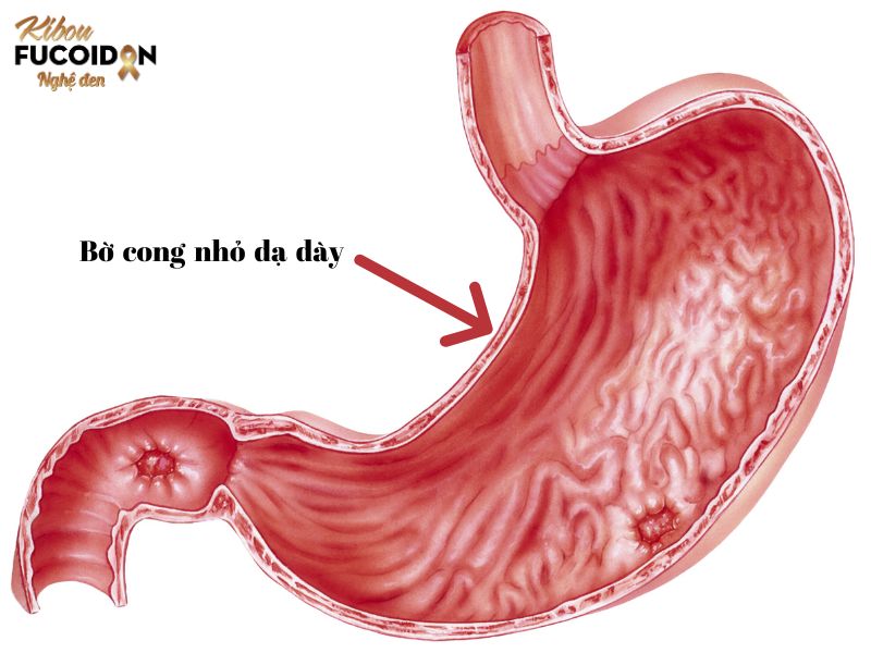 Hình ảnh bờ cong nhỏ dạ dày