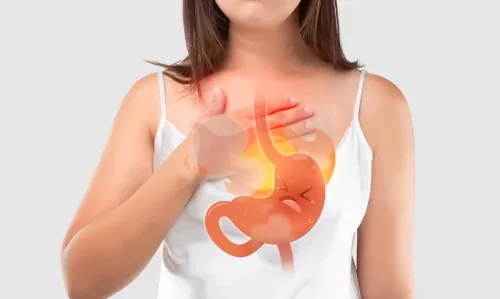 Ợ hơi ợ chua ợ nóng