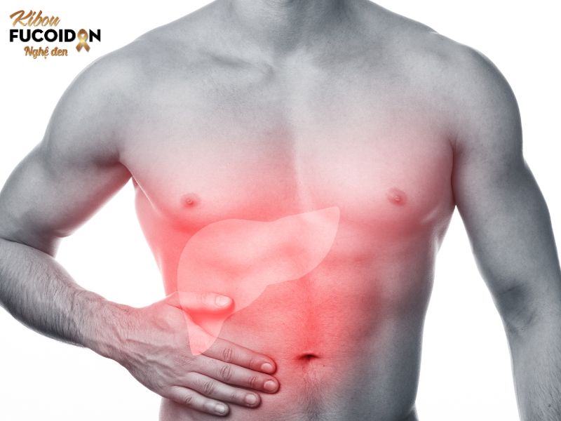 Ung thư biểu mô tế bào gan: Nguyên nhân, dấu hiệu và điều trị Dấu hiệu của bệnh ung thư biểu mô tế bào gan