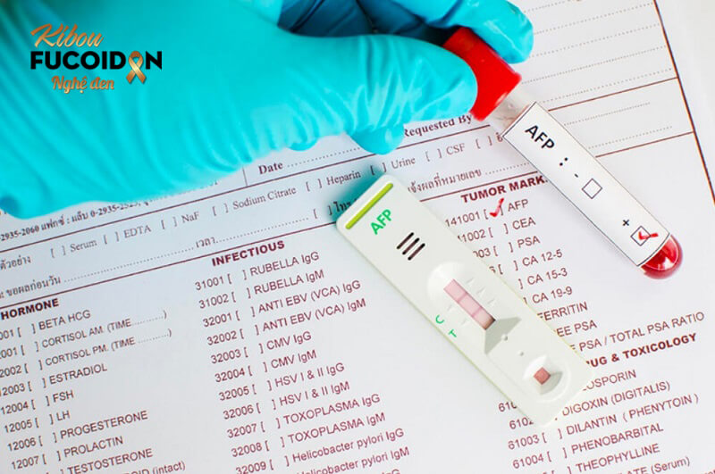Top 4 xét nghiệm ung thư gan chính xác nhất hiện nay Các chỉ số xét nghiệm ung thư gan