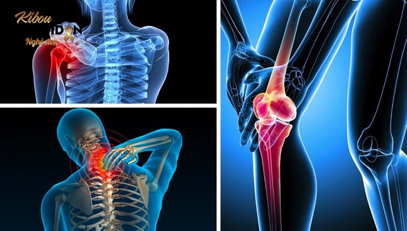 Ung thư gan di căn xương: Dấu hiệu, điều trị và chăm sóc Đau xương