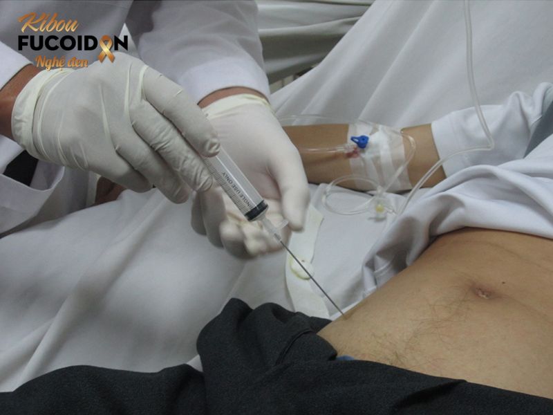 Hút dịch ung thư gan: Chỉ định và quy trình thực hiện Hút dịch ung thư gan