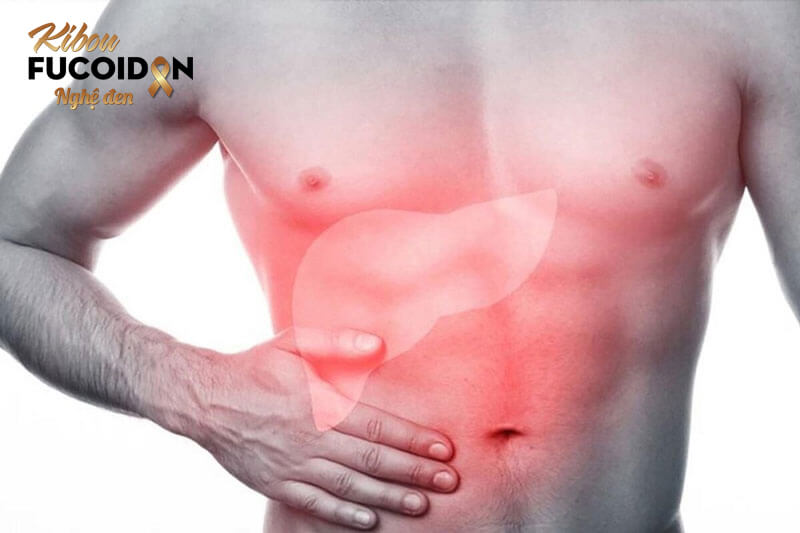 Ung thư gan giai đoạn cuối nôn ra máu: Nguyên nhân và cách xử lý Nguyên nhân ung thư gan nôn ra máu