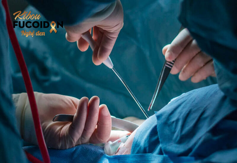 Quy trình mổ ung thư gan, các biến chứng và cách đối phó Phẫu thuật cắt bỏ một phần gan