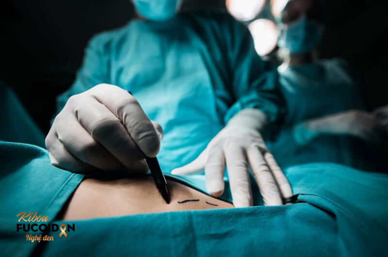 Ung thư dạ dày di căn gan. Nhận biết và điều trị Ung thư dạ dày di căn gan có phẫu thuật được không?