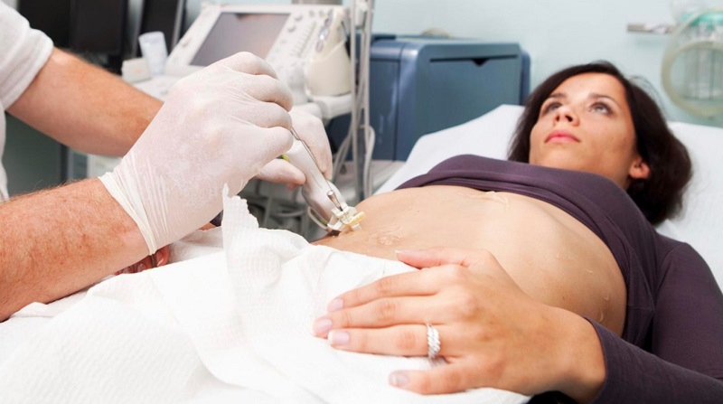 Sinh thiết gan là gì? Quy trình và thông tin cần biết Sinh thiết gan là gì?