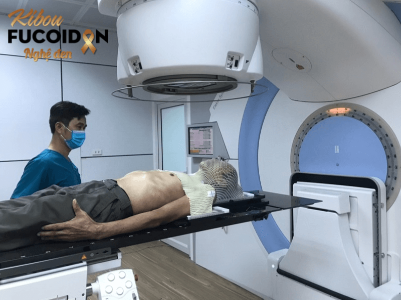 Bật mí thông tin bạn chưa biết về xạ trị ung thư đại trực tràng Xạ trị ngoài