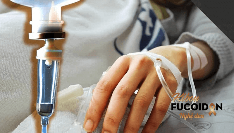 Hóa trị thường được sử dụng trước hoặc sau phẫu thuật ung thư đại tràng để nâng cao hiệu quả điều trị