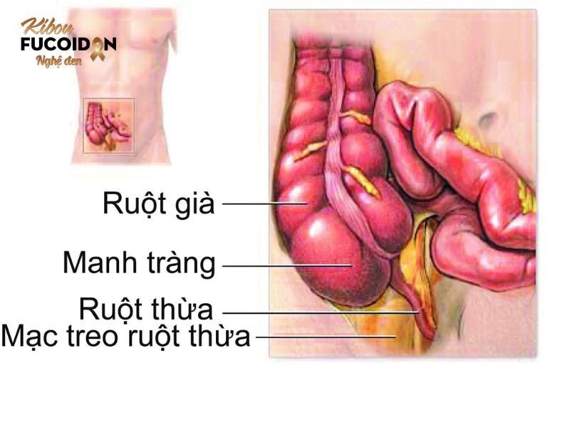 Manh tràng, còn gọi là ruột non. Manh tràng, còn gọi là ruột non.