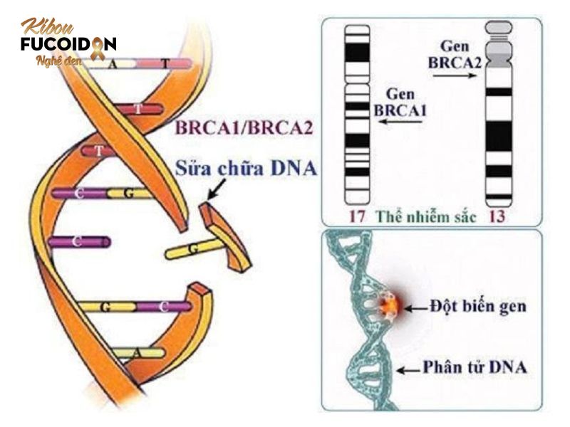Ung thu vú ở đàn ông có nguy hiểm không? Dấu hiệu và cách điều trị Đột biến gen là một trong những nguyên nhân gây ung thư vú ở nam giới