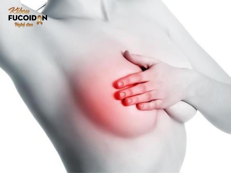 Cẩm nang thông tin về thuốc điều trị ung thư vú bạn nên biết Nhiều loại thuốc được sử dụng để điều trị ung thư vú