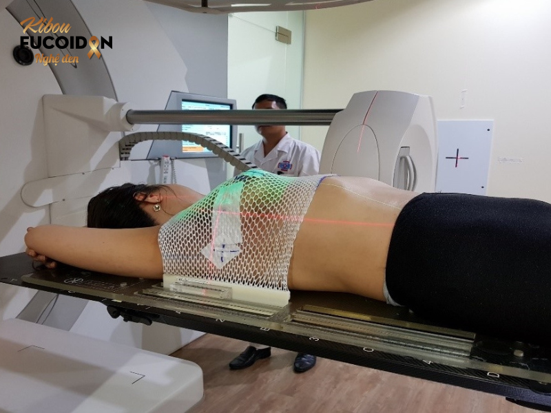 Xạ trị ung thư vú: Chỉ định, chi phí và tác dụng phụ Xạ trị bệnh ung thư vú