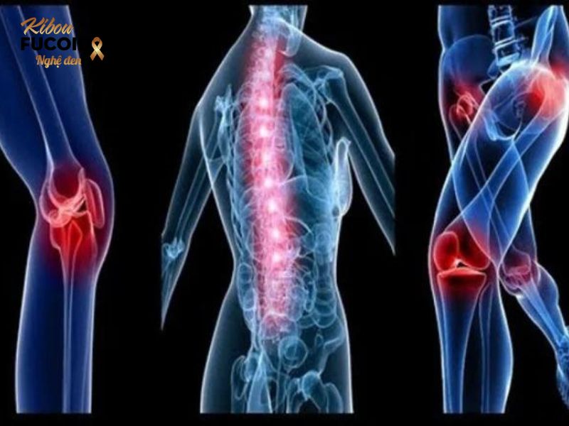 Từ A đến Z về Ung thư đại tràng di căn xương Một số vị trí xương mà tế bào ung thư đại tràng thường di căn tới