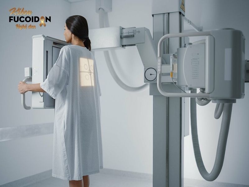 Từ A đến Z về Ung thư phổi không tế bào nhỏ Chụp X-Quang phổi