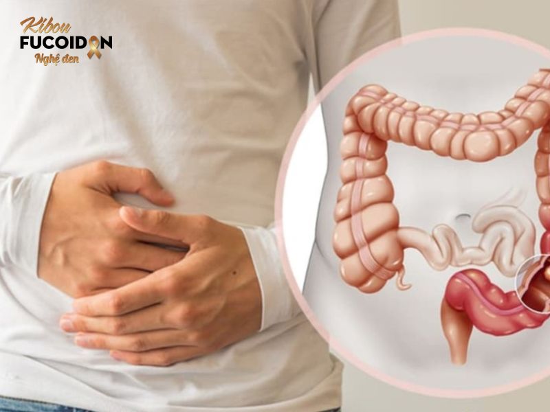 Tại sao ung thư đại tràng tái phát? Cách điều trị thế nào? Đau bụng, đầy hơi là một trong những dấu hiệu điển hình cảnh báo bệnh ung thư đại tràng tái phát