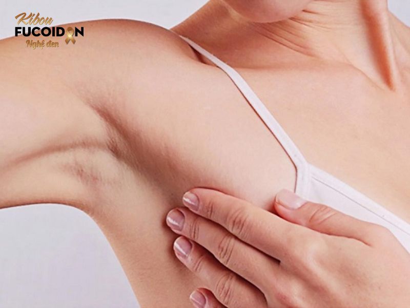 Ung thư vú tái phát: Dấu hiệu, cách điều trị và phòng ngừa Dấu hiệu tái phát ung thư vú