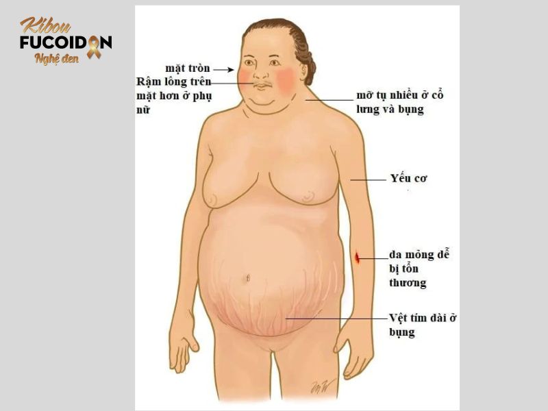 Trọn bộ kiến thức về Ung thư phổi di căn tuyến thượng thận Một số dấu hiệu khi tế bào ung thư phổi di căn đến tuyến thượng thận