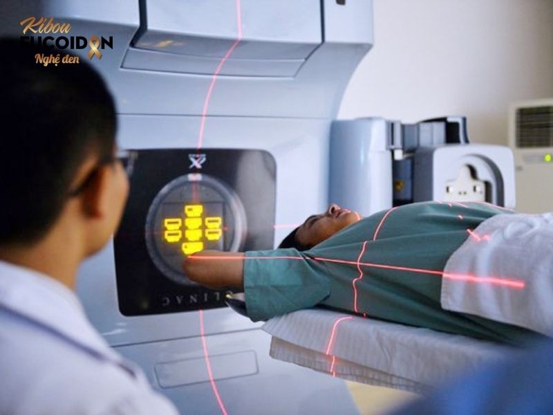5 điều quan trọng về xạ trị ung thư phổi, bạn cần nhớ! Xạ trị ngoài