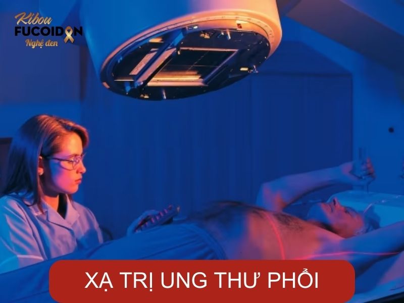 5 điều quan trọng về xạ trị ung thư phổi, bạn cần nhớ! Phương pháp xạ trị ung thư phổi