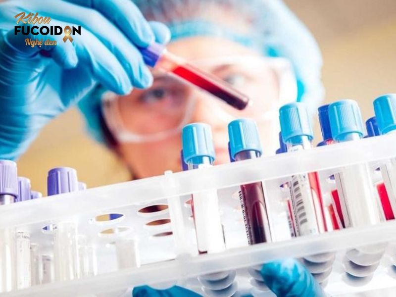 Tìm hiểu chi tiết xét nghiệm máu phát hiện ung thư đại tràng Xét nghiệm máu phát hiện ung thư đại tràng