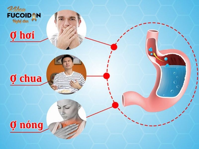 Ợ hơi, ợ chua, ợ nóng có thể là dấu hiệu cảnh báo ung thư dạ dày giai đoạn 2