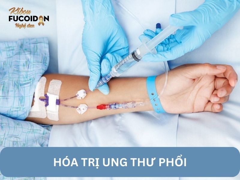 Tìm hiểu về phương pháp hóa trị ung thư phổi Tìm hiểu về phương pháp hóa trị ung thư phổi