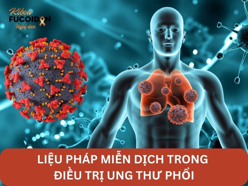 Tìm hiểu về liệu pháp miễn dịch trong điều trị ung thư phổi Tìm hiểu về liệu pháp miễn dịch trong điều trị ung thư phổi