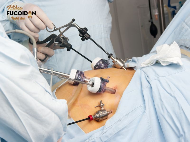 Có nên phẫu thuật ung thư dạ dày? Phẫu thuật sống được bao lâu? Hình ảnh phẫu thuật ung thư dạ dày