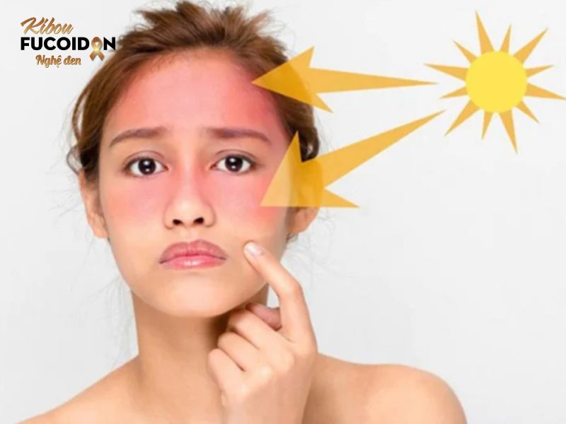 Nguyên nhân gây ung thư - Giật mình vì 80% người Việt đang mắc phải Bức xạ cực tím có thể gây ung thư da