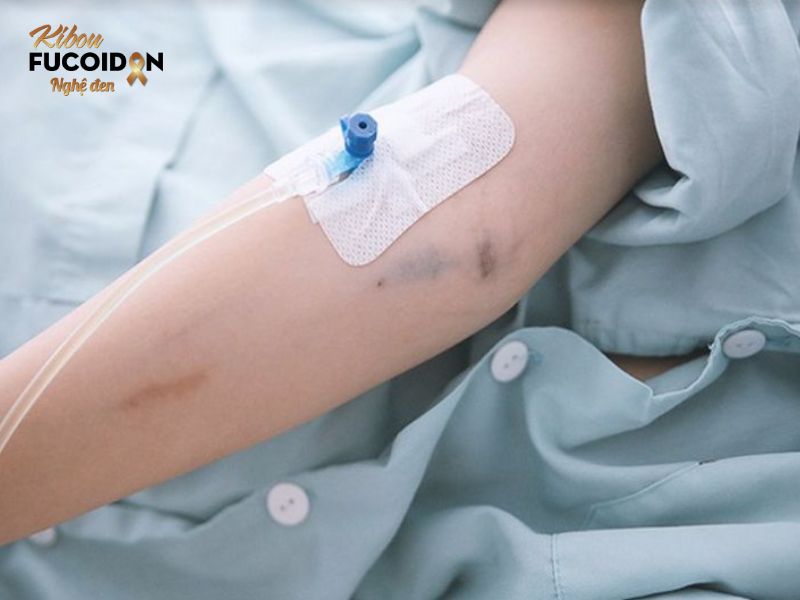 Ung thư nên ăn gì, kiêng gì? - Giá như bạn biết sớm hơn Truyền dinh dưỡng cần thiết cho cơ thể trong trường hợp bệnh nhân không ăn uống được