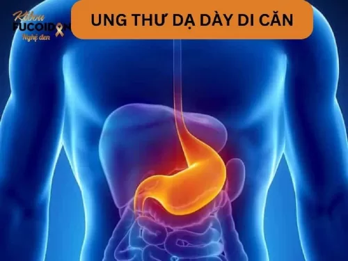 Dấu hiệu, chẩn đoán và cách điều trị Ung thư dạ dày di căn