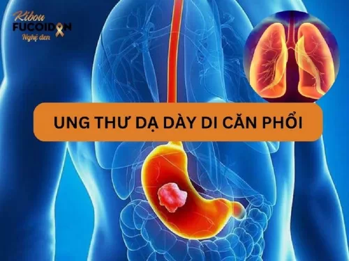 Sự nguy hiểm của ung thư dạ dày di căn phổi