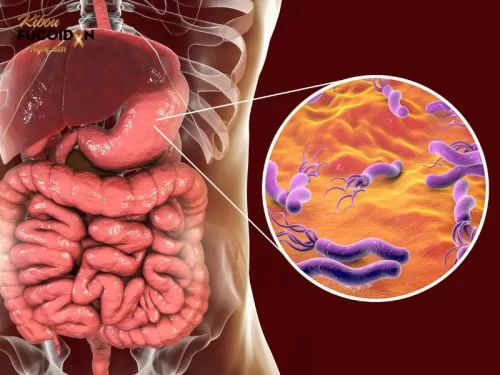 Vi khuẩn HP (Helicobacter Pylori)