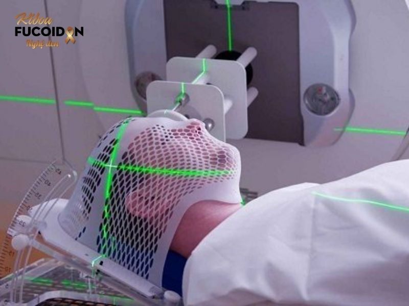 Dấu hiệu, chẩn đoán và cách điều trị Ung thư dạ dày di căn Phương pháp xạ trị