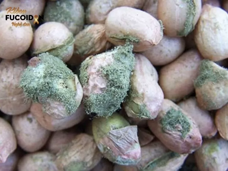 Chuyên gia giải đáp: Ung thư có ăn được lạc không? Không ăn những hạt lạc bị mốc, hỏng vì có thể ngộ độc do nhiễm nấm Aspergillus flavus