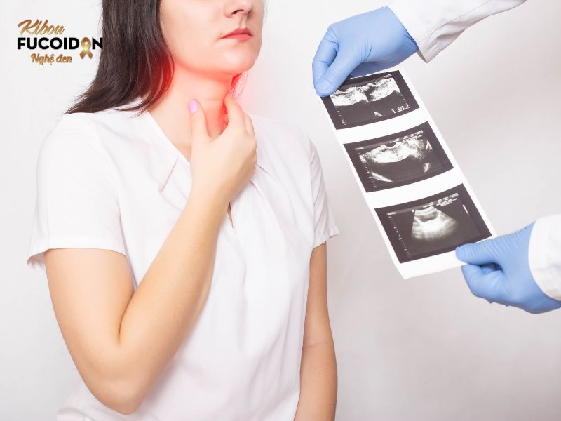 Siêu âm tuyến giáp Siêu âm tuyến giáp