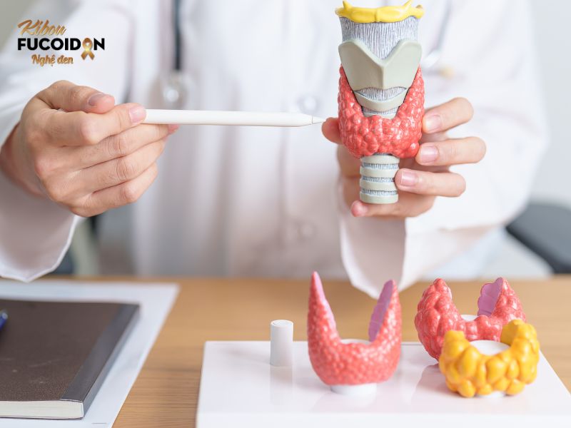 Khối u ở vùng cổ Khối u ở vùng cổ