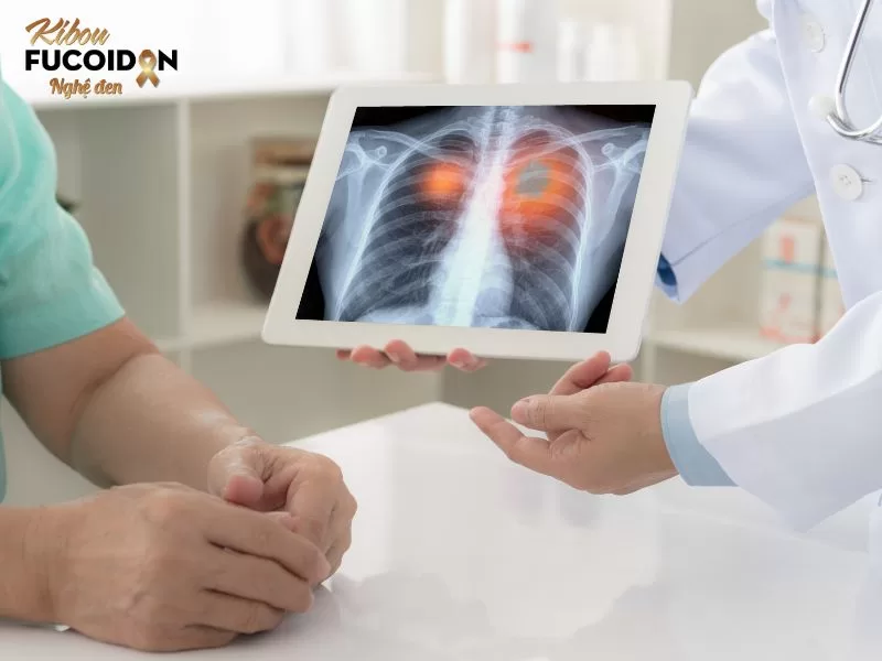 Ung thư nào đau đớn nhất? TOP 7 bệnh ung thư phổ biến nhất hiện nay Ung thư phổi là loại ung thư phổ biến thứ 2 ở cả nam và nữ trên toàn thế giới.