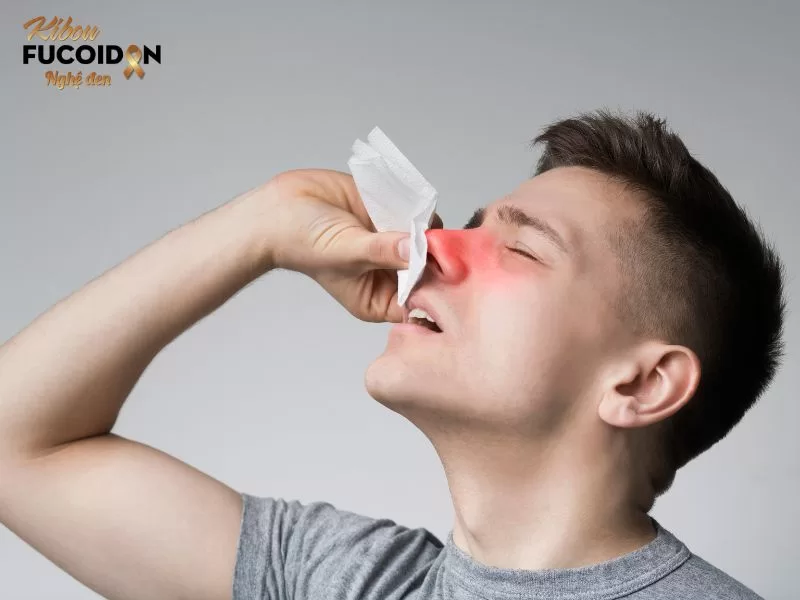 Ngay khi bị chảy máu mũi cần cố gắng cầm máu nhanh nhất có thể