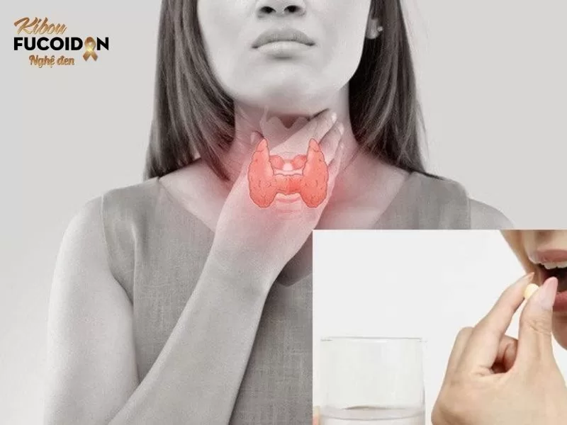 Sau phẫu thuật, người bệnh cần uống thuốc bổ sung hormone tuyến giáp suốt đời