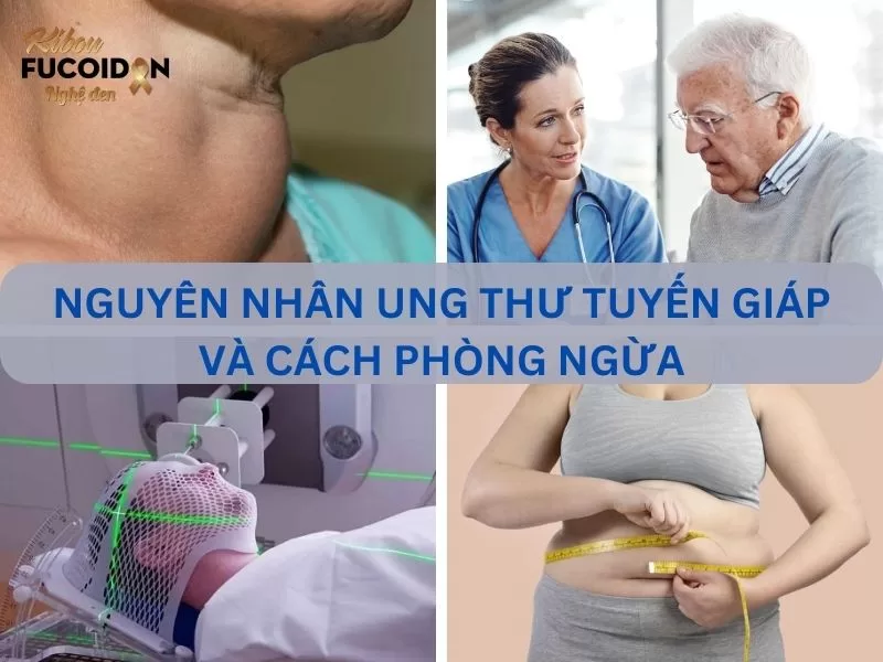 8 nguyên nhân ung thư tuyến giáp thường gặp và cách phòng ngừa Tìm hiểu về các nguyên nhân ung thư tuyến giáp và cách phòng ngừa