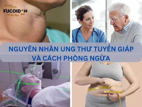 8 nguyên nhân ung thư tuyến giáp thường gặp và cách phòng ngừa